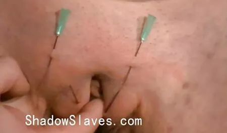 Egy élő sex video érett hölgy látogatása az orvoshoz szexré válik